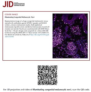 Cover image description for Journal of Investigative Dermatology, January 2025