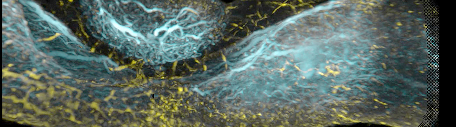 A. Barlier / H. Etchevers