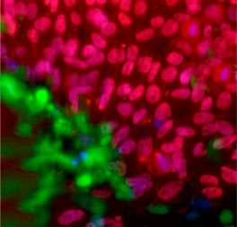 Diseases of the CNS and Neuroendocrine Tissues